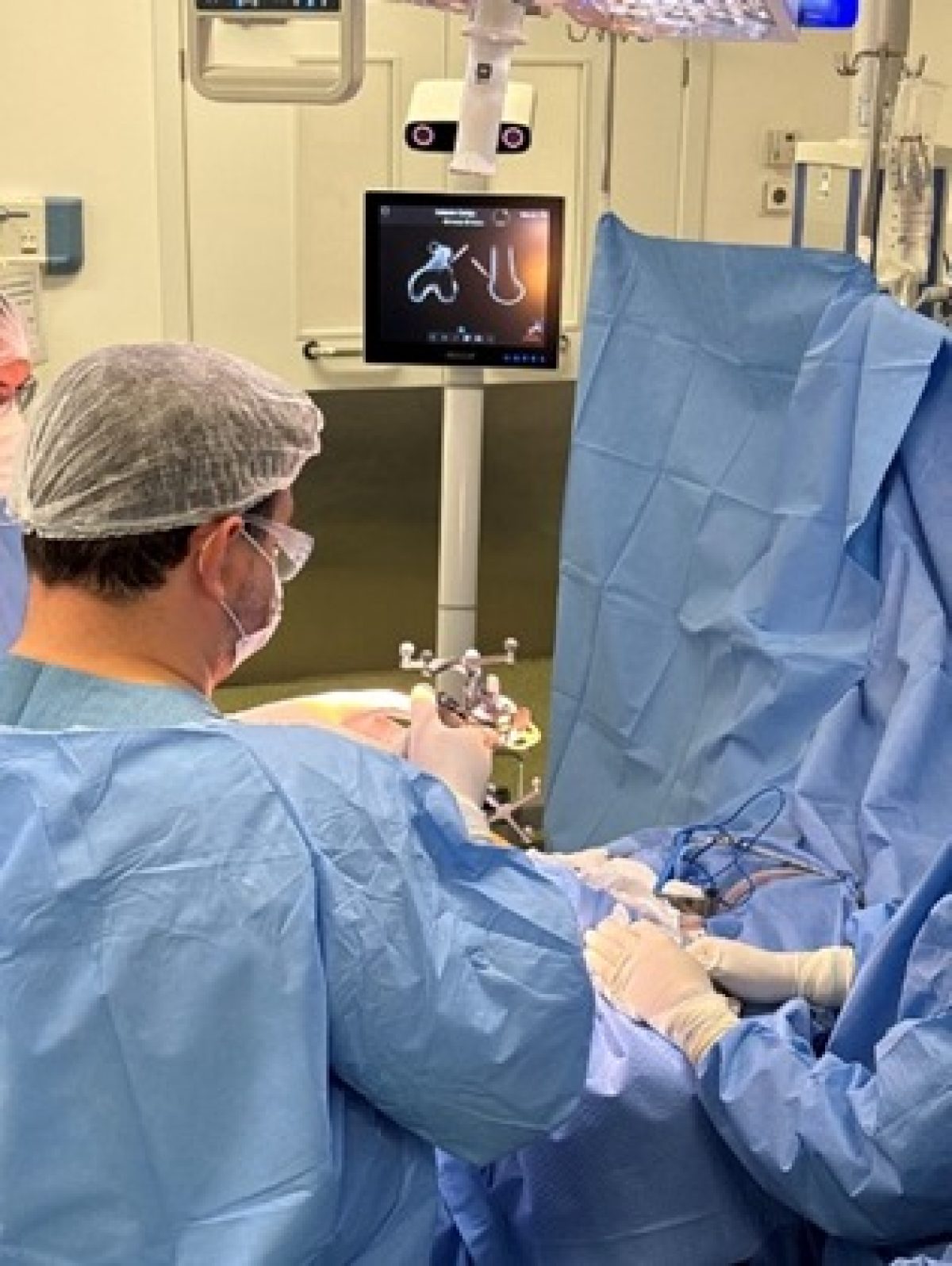 Hospital Regional Unimed Missões realiza primeira cirurgia de joelho com navegação computadorizada na região